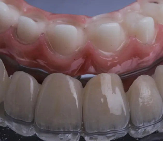 Protese Dentaria
